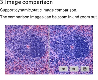 Image comparison