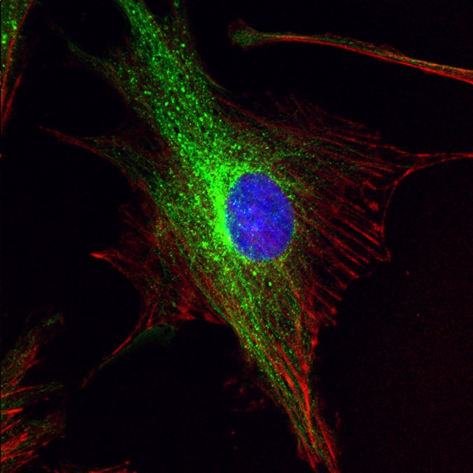 BPAE cell 2, SIMSCOP P series, 60X objective lens